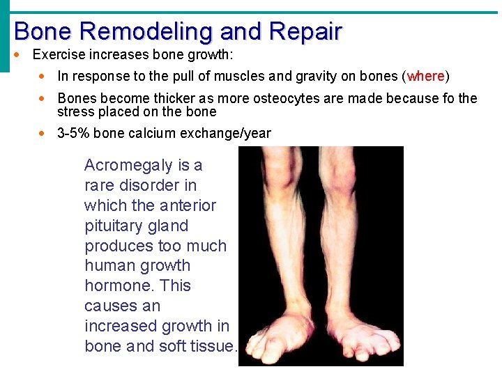 Bone Remodeling and Repair · Exercise increases bone growth: · In response to the