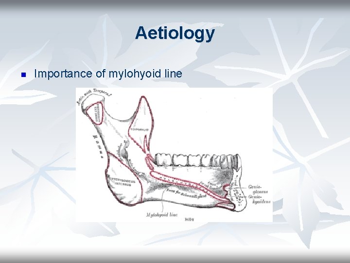 Aetiology n Importance of mylohyoid line 