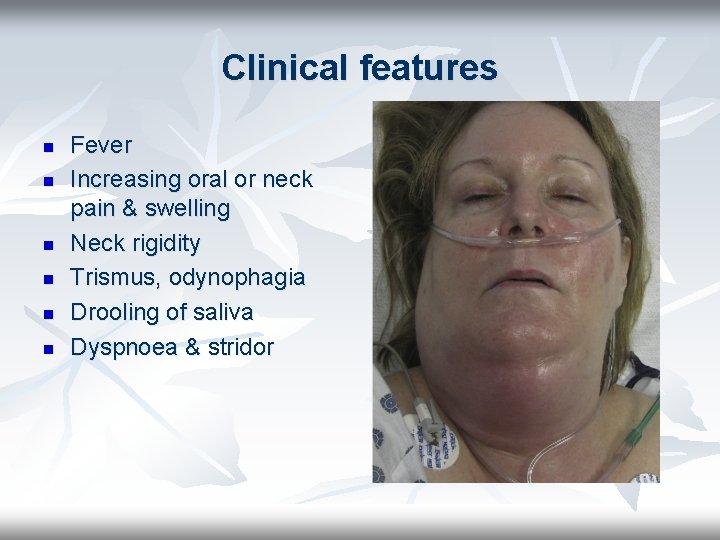 Clinical features n n n Fever Increasing oral or neck pain & swelling Neck