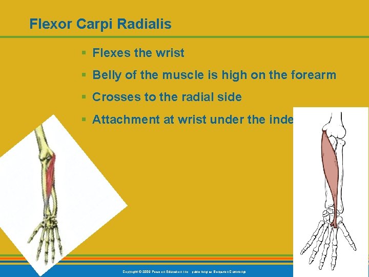 Flexor Carpi Radialis § Flexes the wrist § Belly of the muscle is high