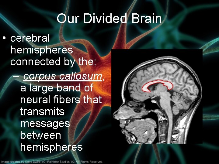 Our Divided Brain • cerebral hemispheres connected by the: – corpus callosum, a large