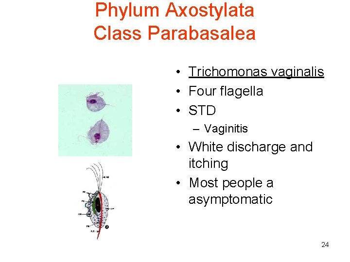 Phylum Axostylata Class Parabasalea • Trichomonas vaginalis • Four flagella • STD – Vaginitis
