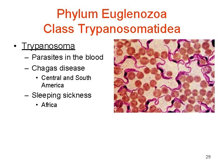 Phylum Euglenozoa Class Trypanosomatidea • Trypanosoma – Parasites in the blood – Chagas disease