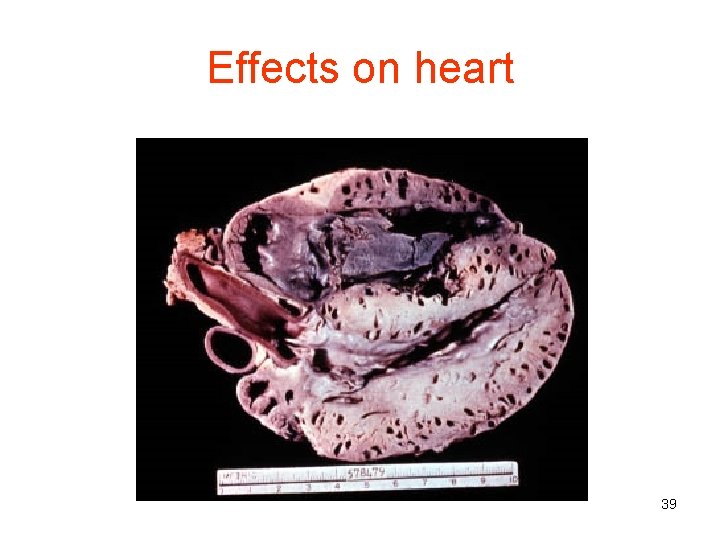 Effects on heart 39 