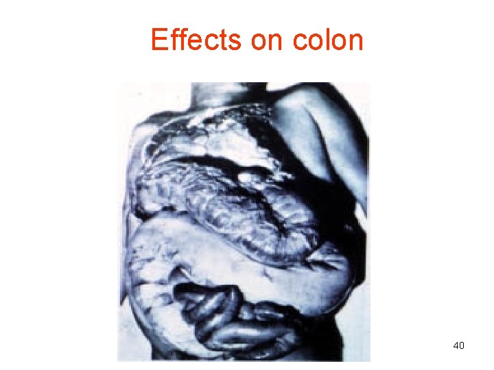 Effects on colon 40 