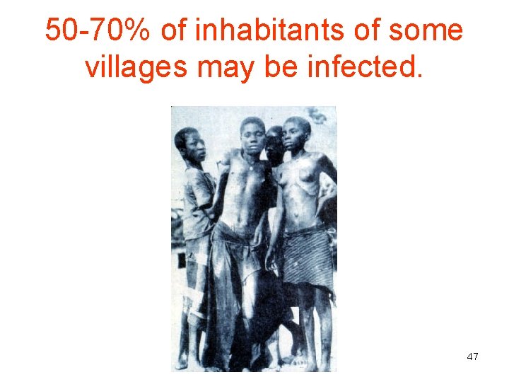 50 -70% of inhabitants of some villages may be infected. 47 