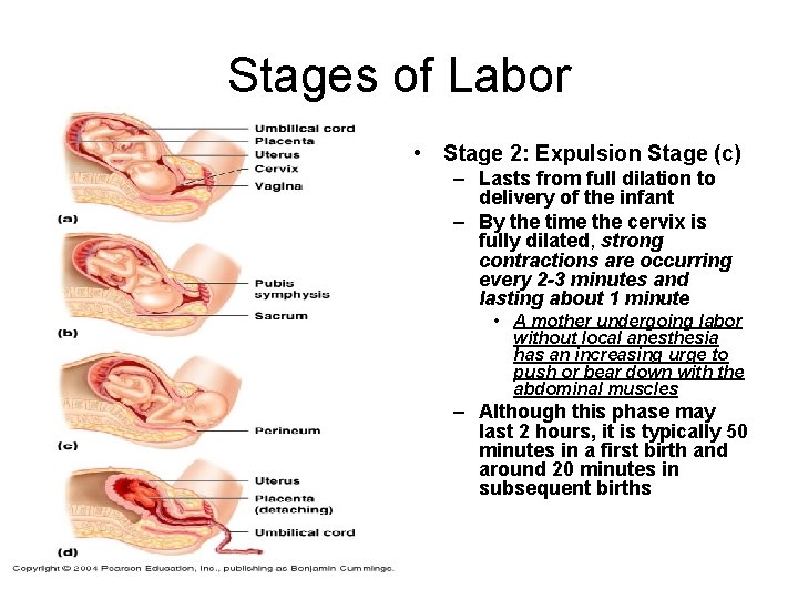 Stages of Labor • Stage 2: Expulsion Stage (c) – Lasts from full dilation