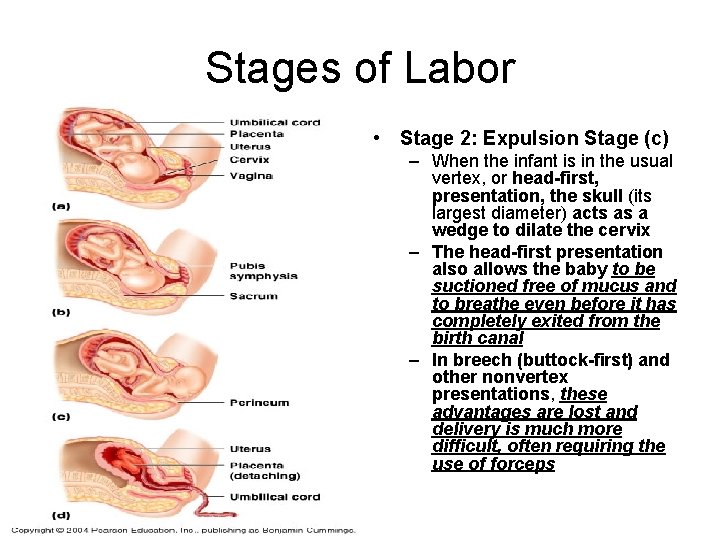 Stages of Labor • Stage 2: Expulsion Stage (c) – When the infant is