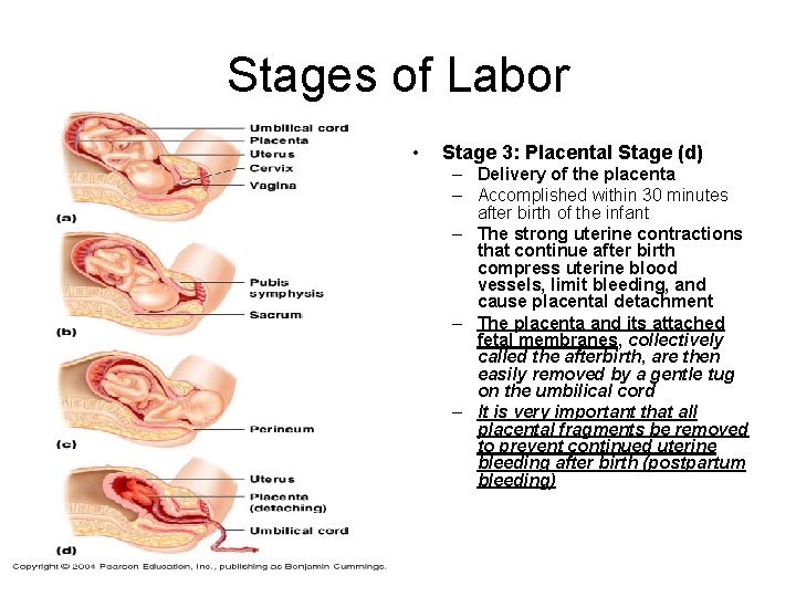 Stages of Labor • Stage 3: Placental Stage (d) – Delivery of the placenta