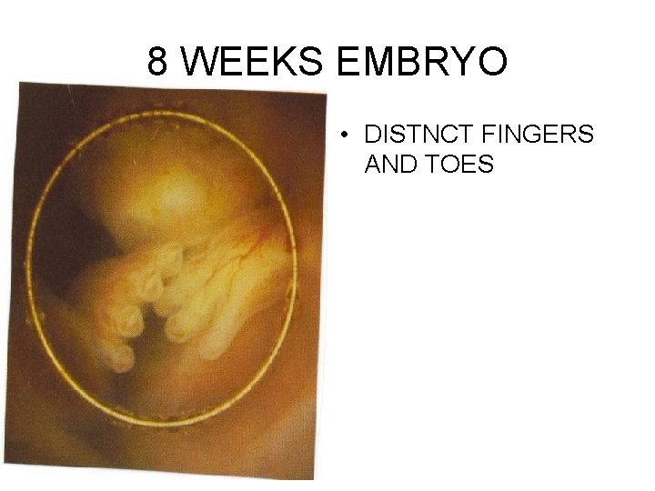 8 WEEKS EMBRYO • DISTNCT FINGERS AND TOES 