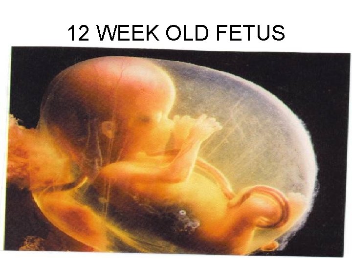 12 WEEK OLD FETUS 