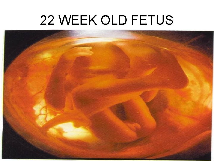 22 WEEK OLD FETUS 