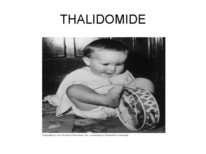 THALIDOMIDE 
