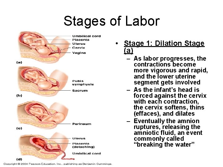 Stages of Labor • Stage 1: Dilation Stage (a) – As labor progresses, the