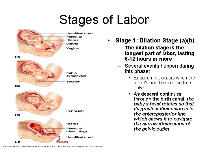 Stages of Labor • Stage 1: Dilation Stage (a)(b) – The dilation stage is