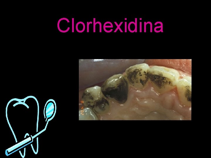 Clorhexidina Clorhexidina