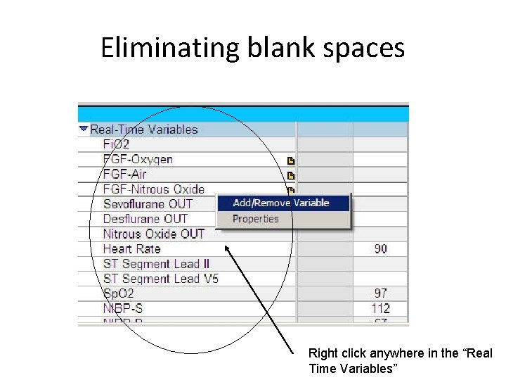 Eliminating blank spaces Right click anywhere in the “Real Time Variables” 