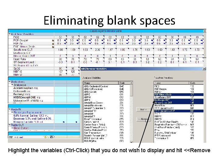 Eliminating blank spaces Highlight the variables (Ctrl-Click) that you do not wish to display