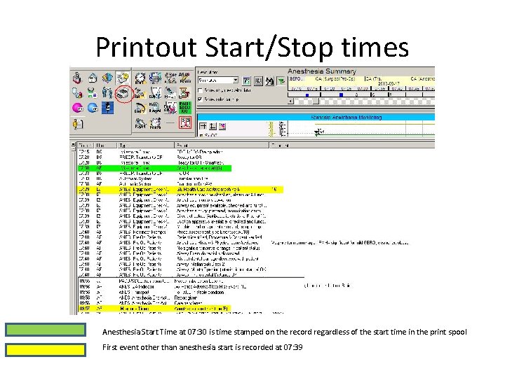 Printout Start/Stop times Anesthesia Start Time at 07: 30 is time stamped on the