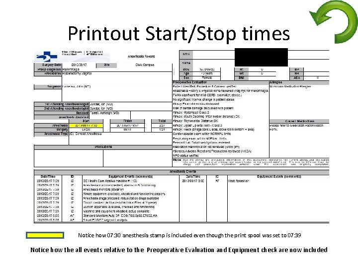 Printout Start/Stop times Notice how 07: 30 anesthesia stamp is included even though the