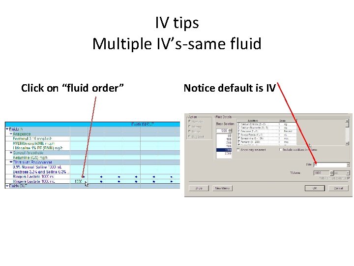 IV tips Multiple IV’s-same fluid Click on “fluid order” Notice default is IV 