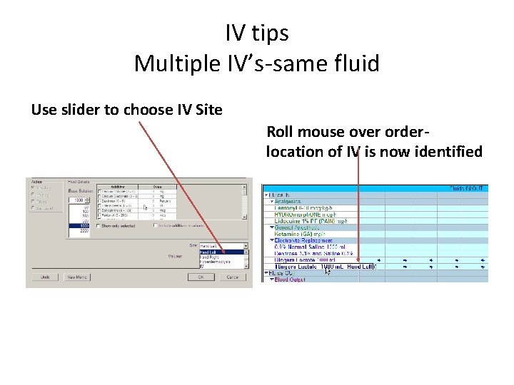 IV tips Multiple IV’s-same fluid Use slider to choose IV Site Roll mouse over