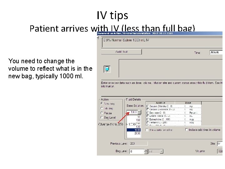 IV tips Patient arrives with IV (less than full bag) You need to change