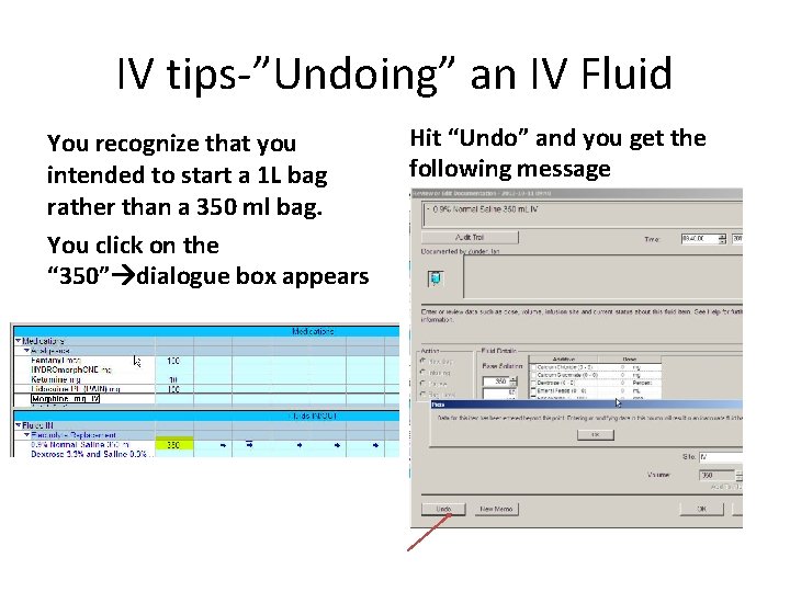 IV tips-”Undoing” an IV Fluid You recognize that you intended to start a 1