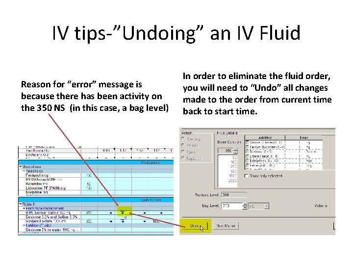 IV tips-”Undoing” an IV Fluid Reason for “error” message is because there has been