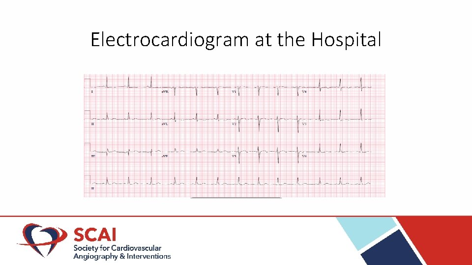 Electrocardiogram at the Hospital 