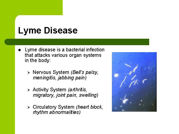 Lyme Disease l Lyme disease is a bacterial infection that attacks various organ systems Lyme Disease l Lyme disease is a bacterial infection that attacks various organ systems
