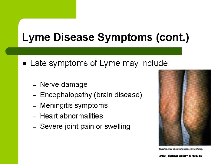 Lyme Disease Symptoms (cont. ) l Late symptoms of Lyme may include: – – Lyme Disease Symptoms (cont. ) l Late symptoms of Lyme may include: – –