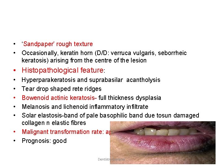  • ‘Sandpaper’ rough texture • Occasionally, keratin horn (D/D: verruca vulgaris, seborrheic keratosis)