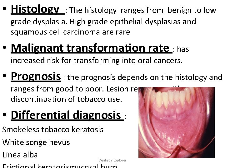  • Histology : The histology ranges from benign to low grade dysplasia. High