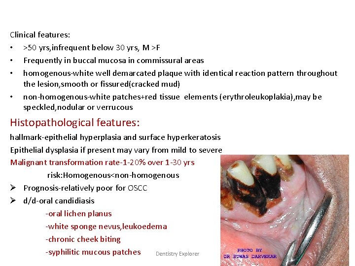 Clinical features: • >50 yrs, infrequent below 30 yrs, M >F • Frequently in