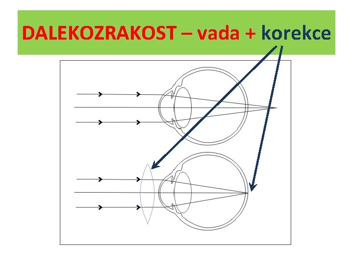 DALEKOZRAKOST – vada + korekce 