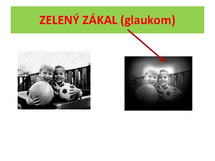 ZELENÝ ZÁKAL (glaukom) 