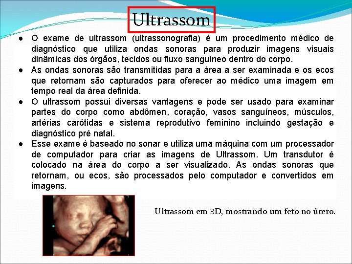 Ultrassom ● O exame de ultrassom (ultrassonografia) é um procedimento médico de diagnóstico que