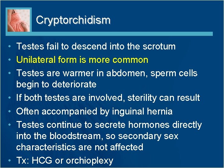Cryptorchidism • Testes fail to descend into the scrotum • Unilateral form is more