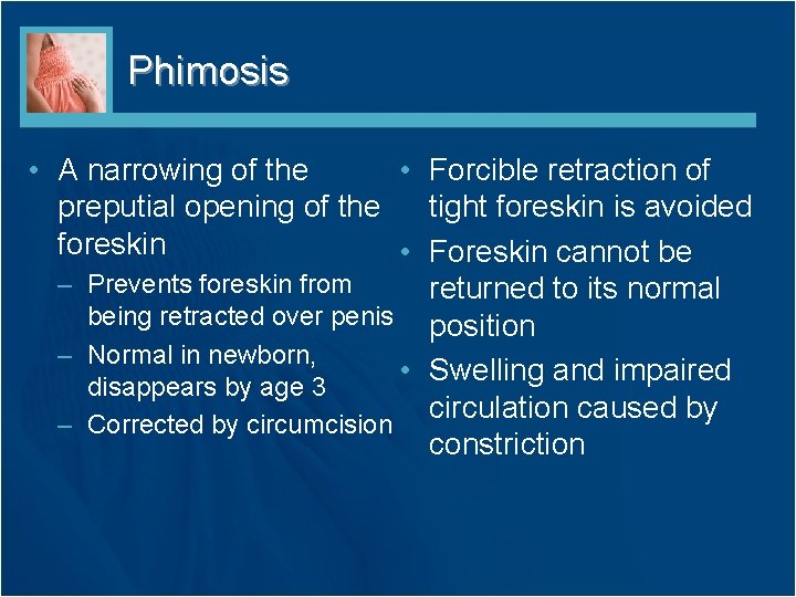 Phimosis • A narrowing of the • Forcible retraction of preputial opening of the