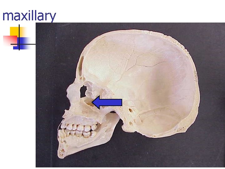 maxillary 