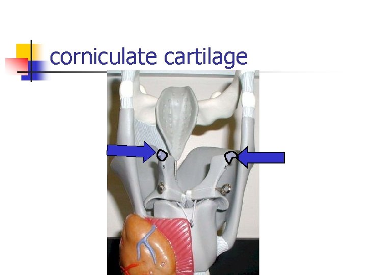corniculate cartilage 