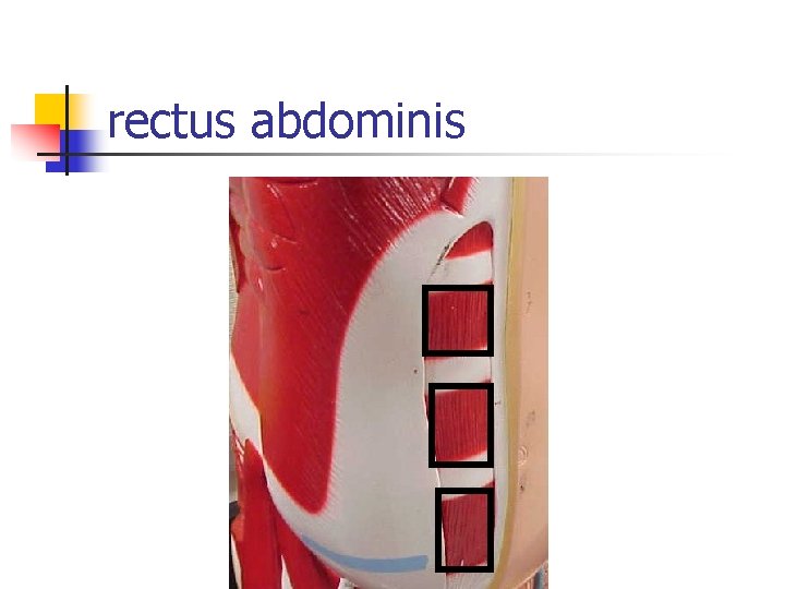 rectus abdominis 