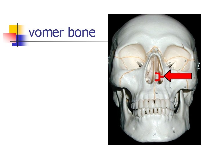 vomer bone 