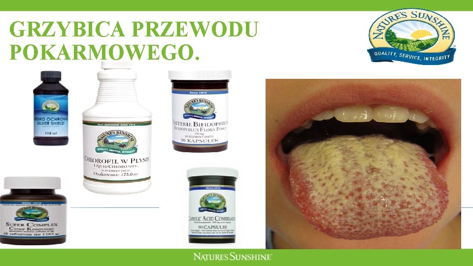 GRZYBICA PRZEWODU POKARMOWEGO. GRZYBICA PRZEWODU POKARMOWEGO.
