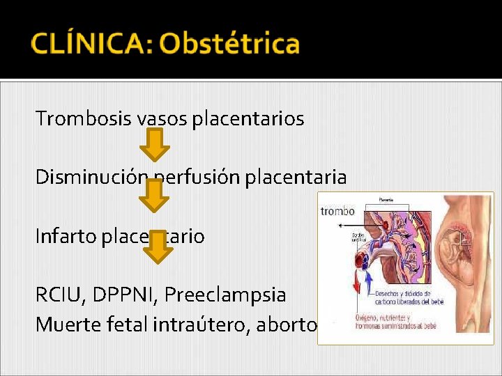 Trombosis vasos placentarios Disminución perfusión placentaria Infarto placentario RCIU, DPPNI, Preeclampsia Muerte fetal intraútero,