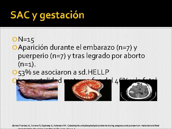  N=15 Aparición durante el embarazo (n=7) y puerperio (n=7) y tras legrado por