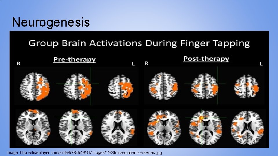 Neurogenesis Image: http: //slideplayer. com/slide/9784949/31/images/12/Stroke+patients+rewired. jpg 