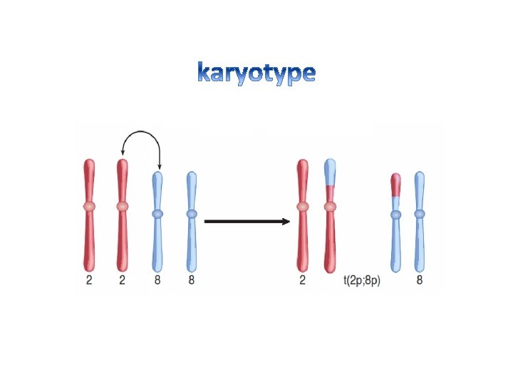 46, XY, t(2 p; 8 p) 