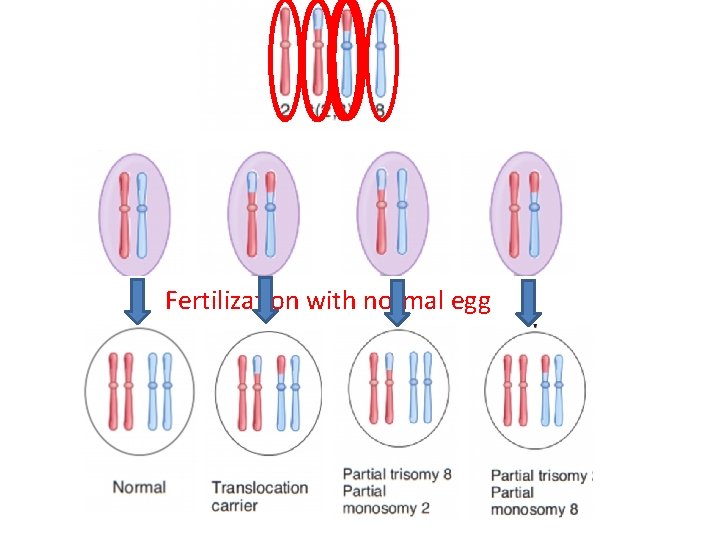 Fertilization with normal egg 